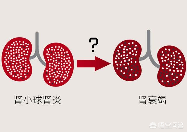 今日科普一下！每天三顿辣椒肾衰竭,百科词条爱好_2024最新更新