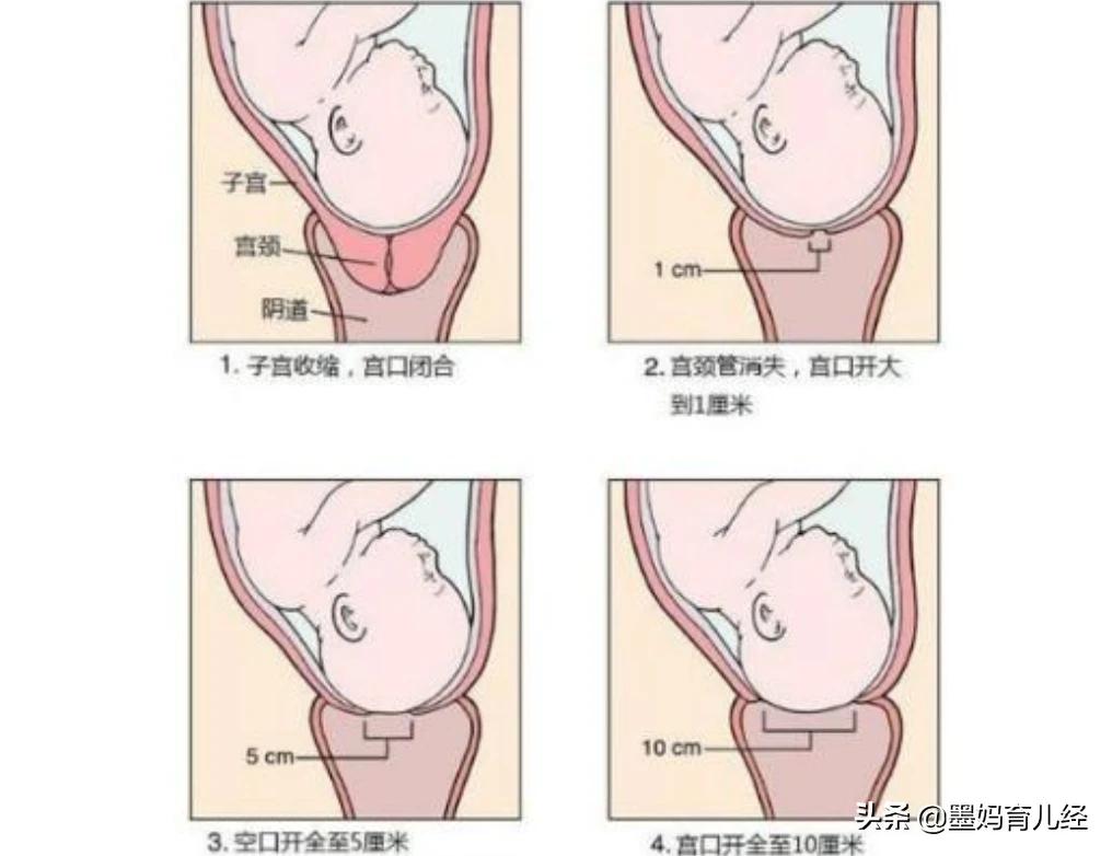 今日科普一下！产前4小时才知怀孕,百科词条爱好_2024最新更新