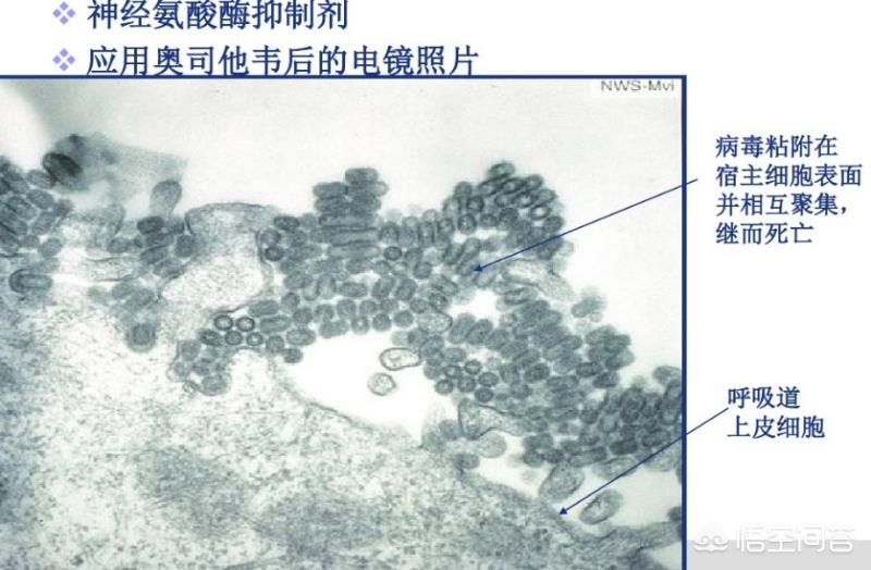 今日科普一下！奥司他韦该怎么吃,百科词条爱好_2024最新更新